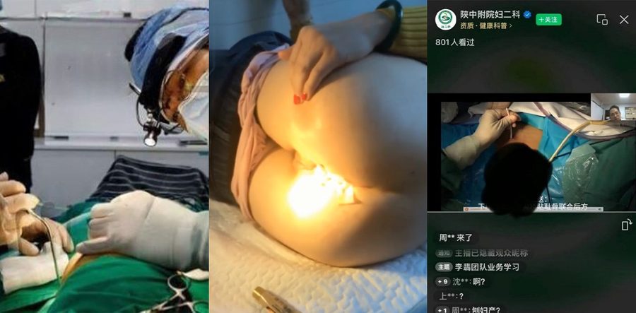 陕中附院妇二科直播手术彻底炸锅！5万人围观无码阴唇 特写患者隐私部位全程高清暴露  医生讲解变调教秀了