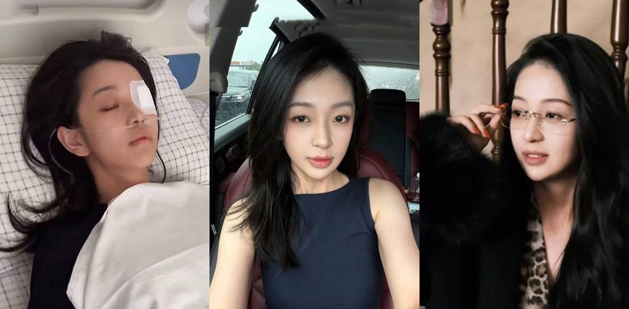 抖音网红 宋瑶 莒县尊亨瑞园抓小三 丈夫张豪梁打伤原配 村书记父亲叫人掩护跑路